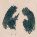 的