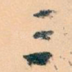 三