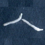 人