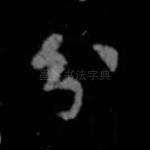 分