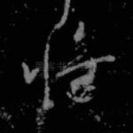 将